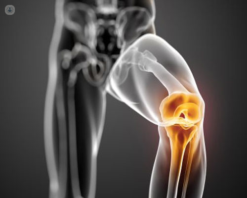 Legamento crociato anteriore e le lesioni periferiche